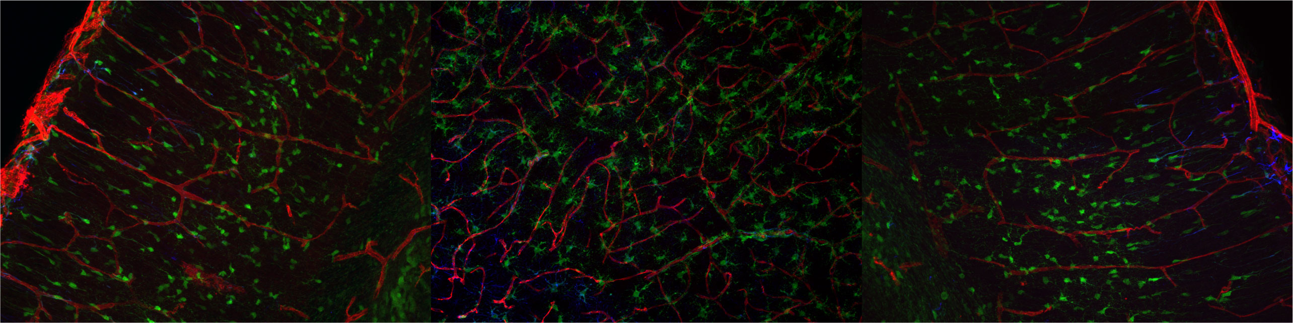 Astrocytes